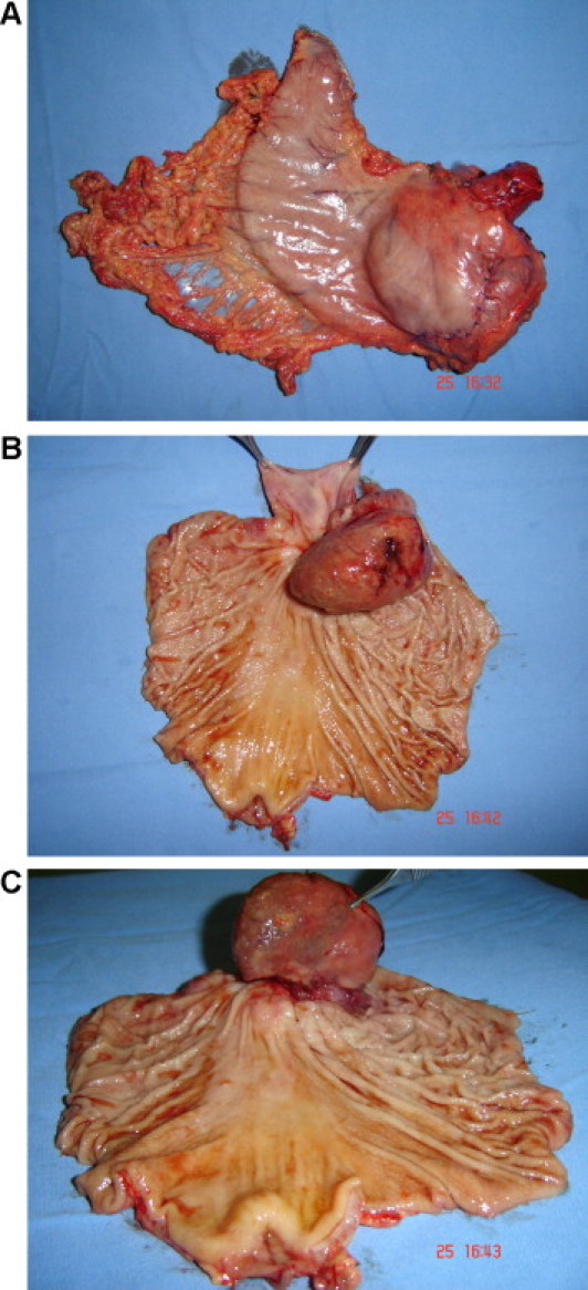 Fig. 3