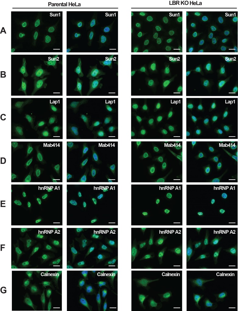 Figure 2—figure supplement 3.