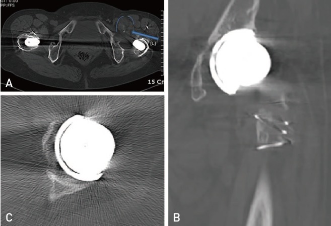 Fig. 2