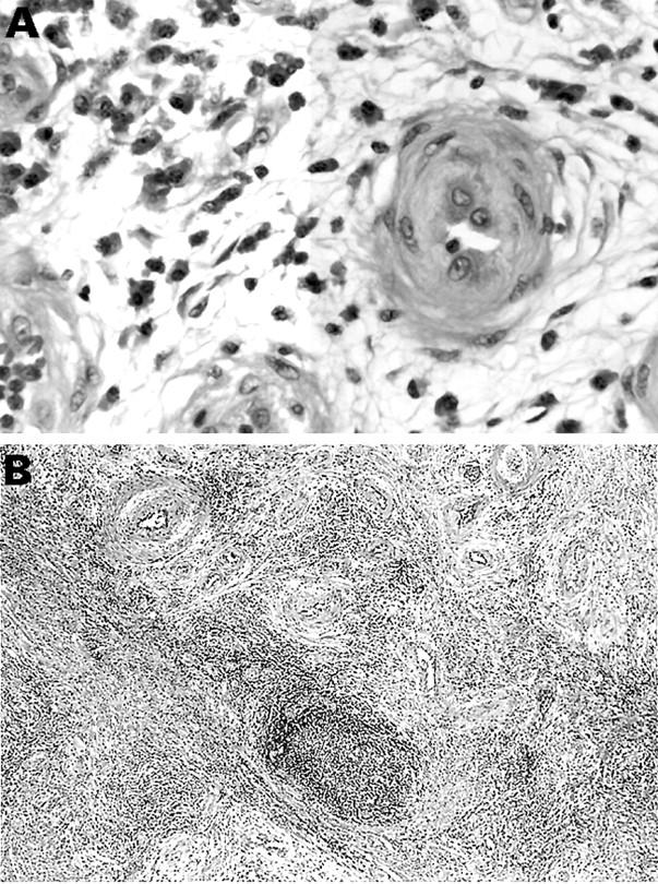 Figure 2  