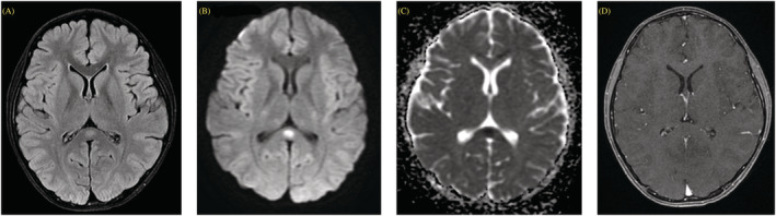 FIGURE 2