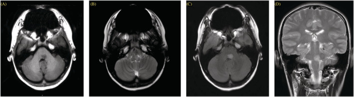 FIGURE 3