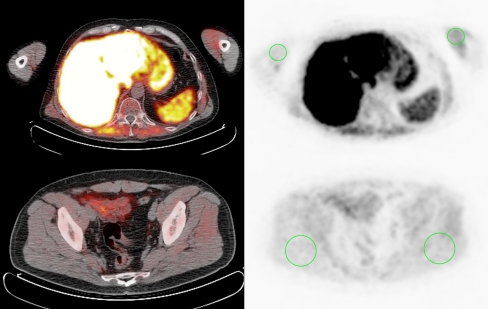 Fig. 1