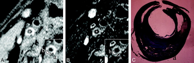 Fig 3.