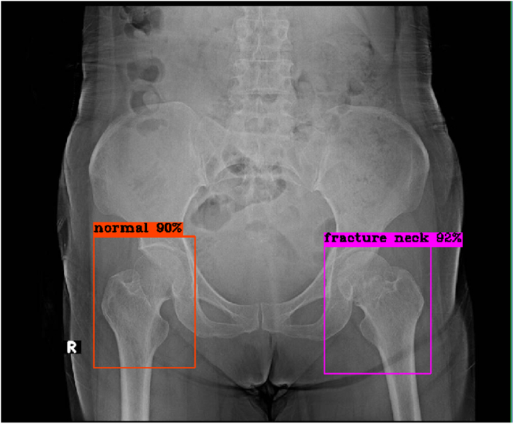 Figure 3