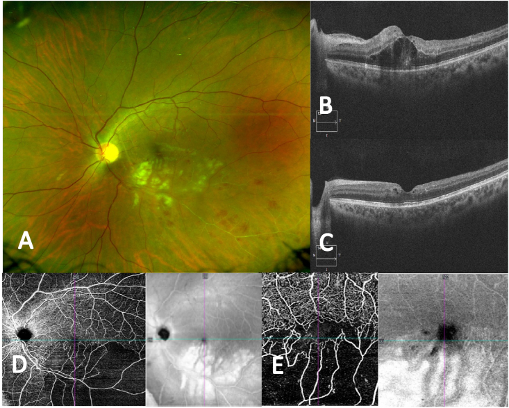 Fig. 4