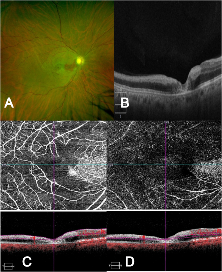 Fig. 2