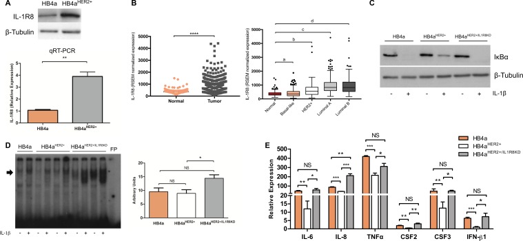 High IL-1R8 expression in breast tumors promotes tumor growth and ...