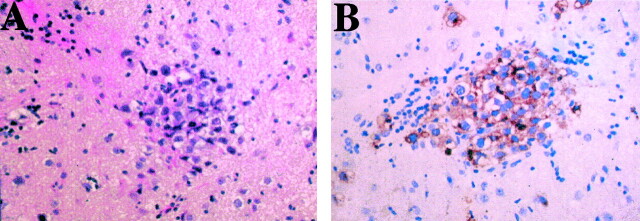 Fig 3.