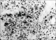 Figure-6