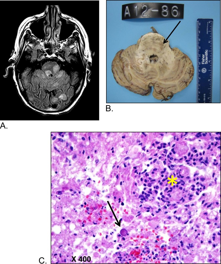 FIG 2