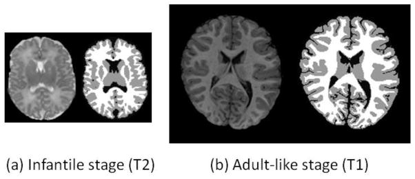 Fig. 15