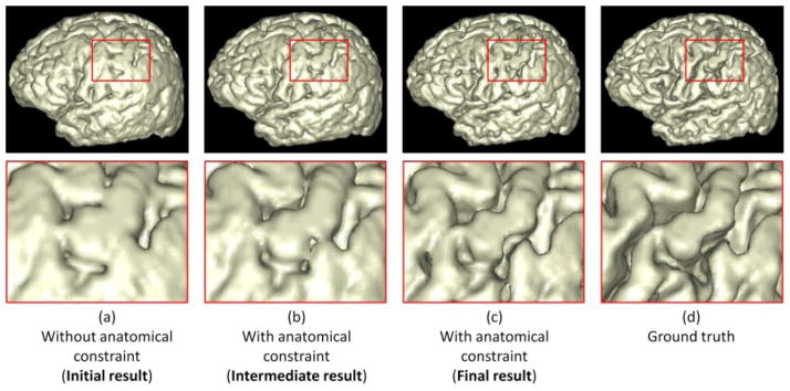 Fig. 11