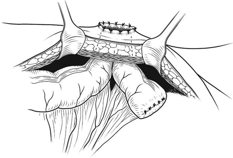 Fig. 15