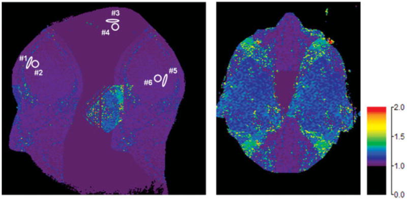 FIG. 3