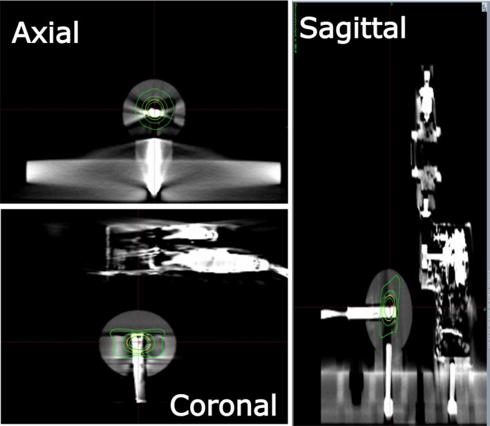 Figure 2