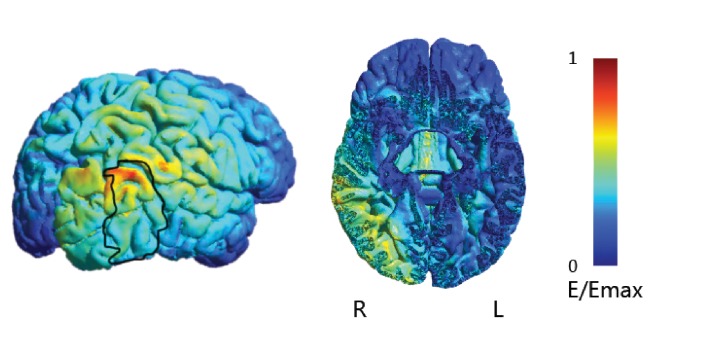 Figure 4—figure supplement 1.