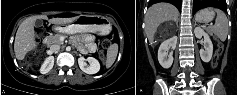 Fig. 13