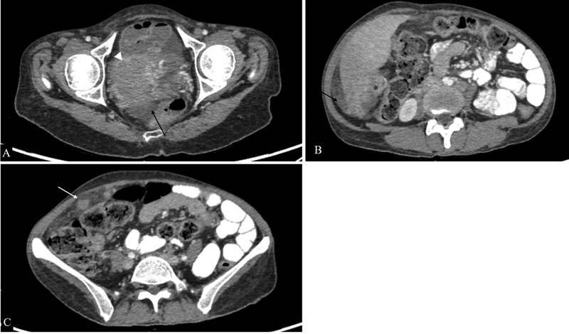 Fig. 12