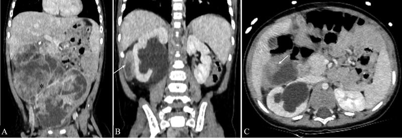 Fig. 11