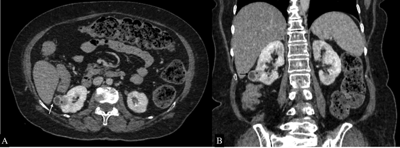 Fig. 10