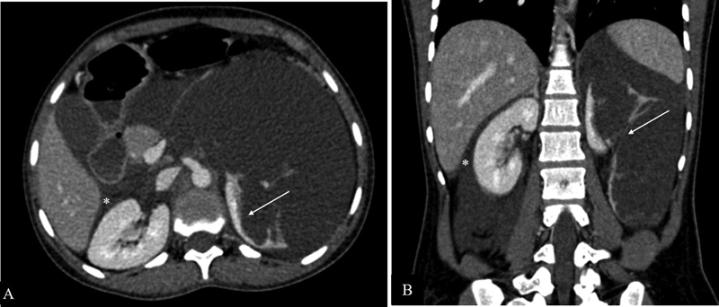 Fig. 14