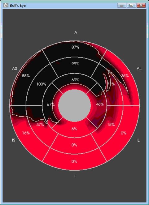 Figure 11.