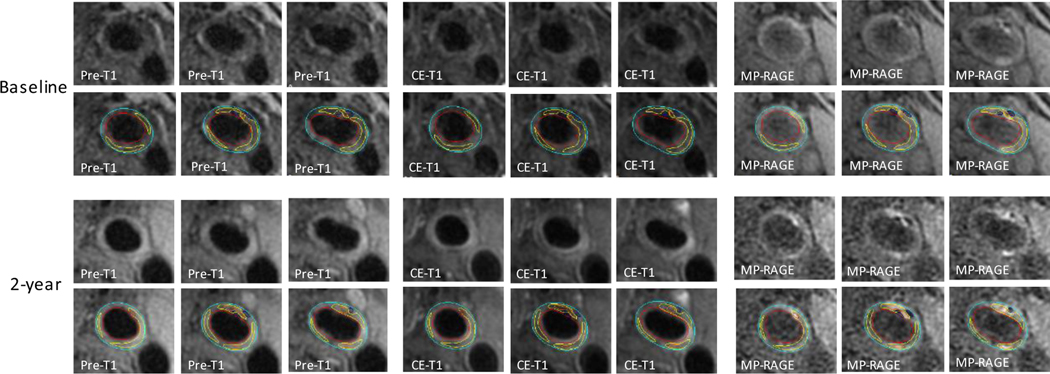 Figure 2: