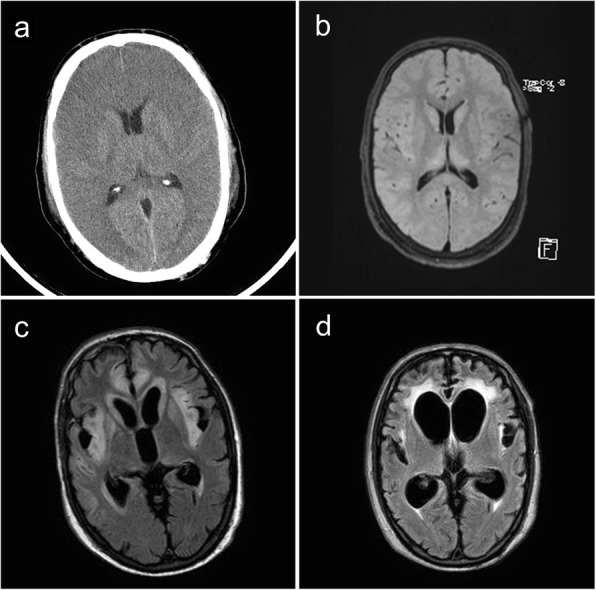 Fig. 2