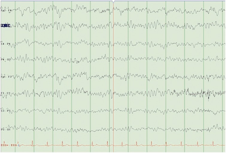 Figure 1.
