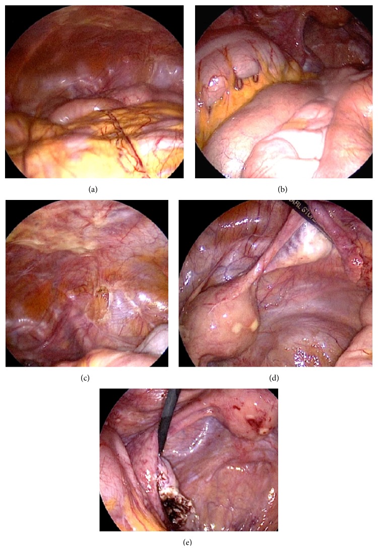 Figure 5