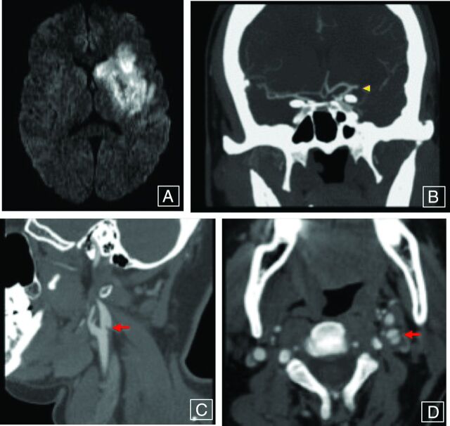 Fig 2.