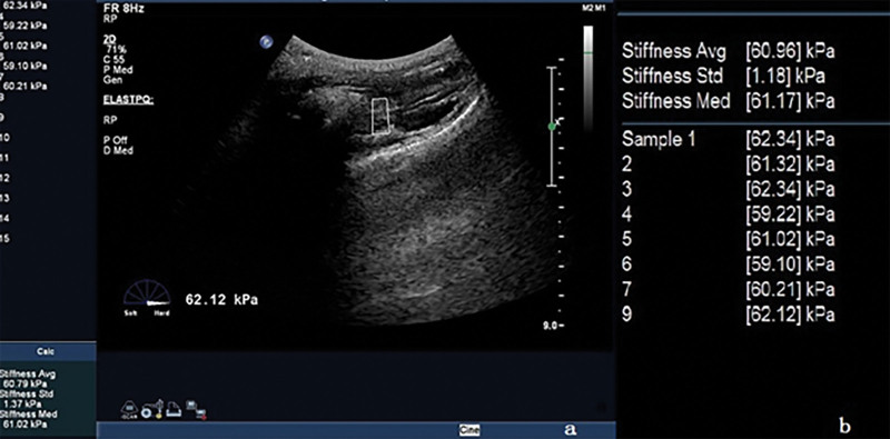 Figure 6.