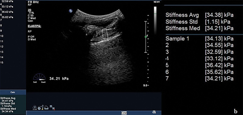 Figure 5.