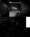 Fig. 12