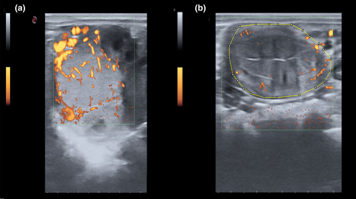 FIGURE 3