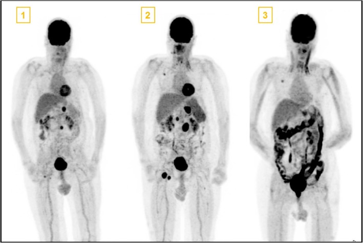 Fig. 2