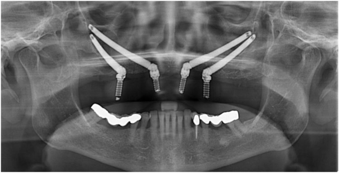 Fig. 14