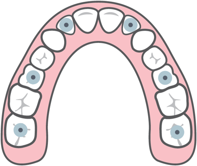 Fig. 15