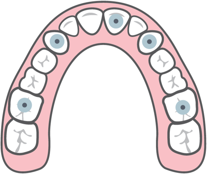 Fig. 4