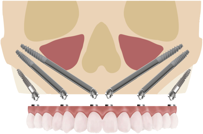 Fig. 16