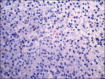Figure 2d