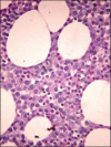 Figure 1d