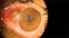 Figure 3A