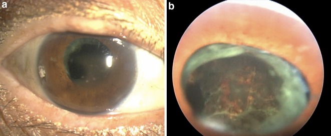 Fig. 6