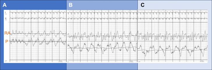 Figure 2