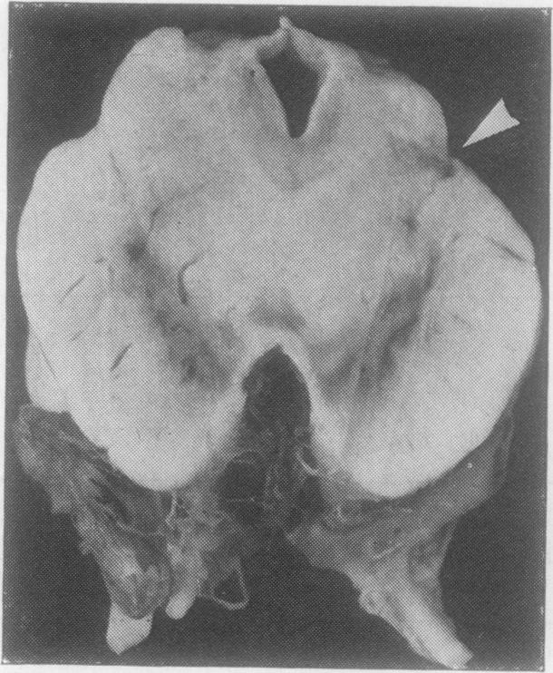 Fig. 9