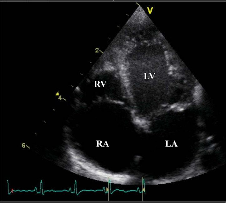 Fig 1