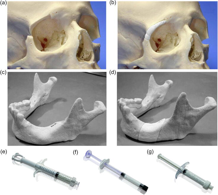 Fig. 10