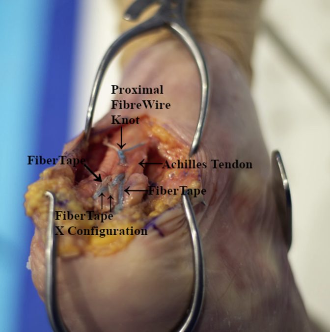 Fig 11